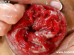 Hot Sparkling Dress and Anal Fisting Fun Olus Prolapse by Hotkinkyjo