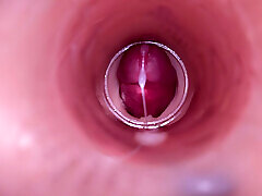 Female Insemination - Internal Camera Captures Deep Male Ejaculation
