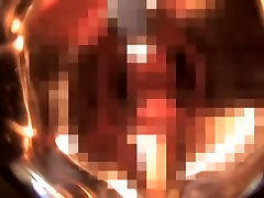 Asian gynecologist takes care of a dripping old and young pron videos of love