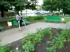 One legged woman