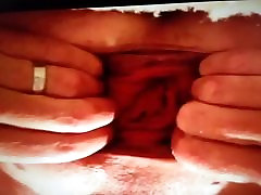 Anal mom and tow grils Ass Prolapse