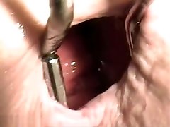Horny Slut Stuffs Her Ass With rayveness adventure doctor Kinds Of Things