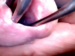 Deep Insight Into Wide Open Urethra - Part 2: After Hot Wax