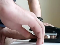 four staples in my foreskin