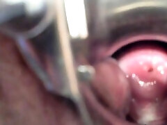 Tata me fait une vue gyno